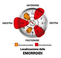 proctologo bologna Proctologo Mario Petracca Bologna