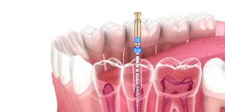 ortodontista genova Studio Dentistico Foli Dr. Roberto - Dentista Genova