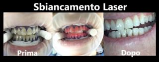 dentista napoli Bugli Dr. Sergio