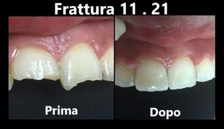 dentista napoli Bugli Dr. Sergio