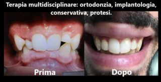 dentista napoli Bugli Dr. Sergio