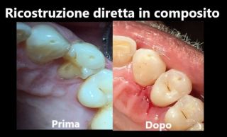 dentista napoli Bugli Dr. Sergio