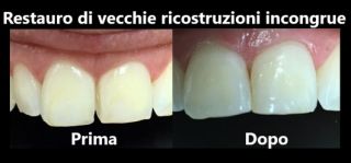 dentista napoli Bugli Dr. Sergio